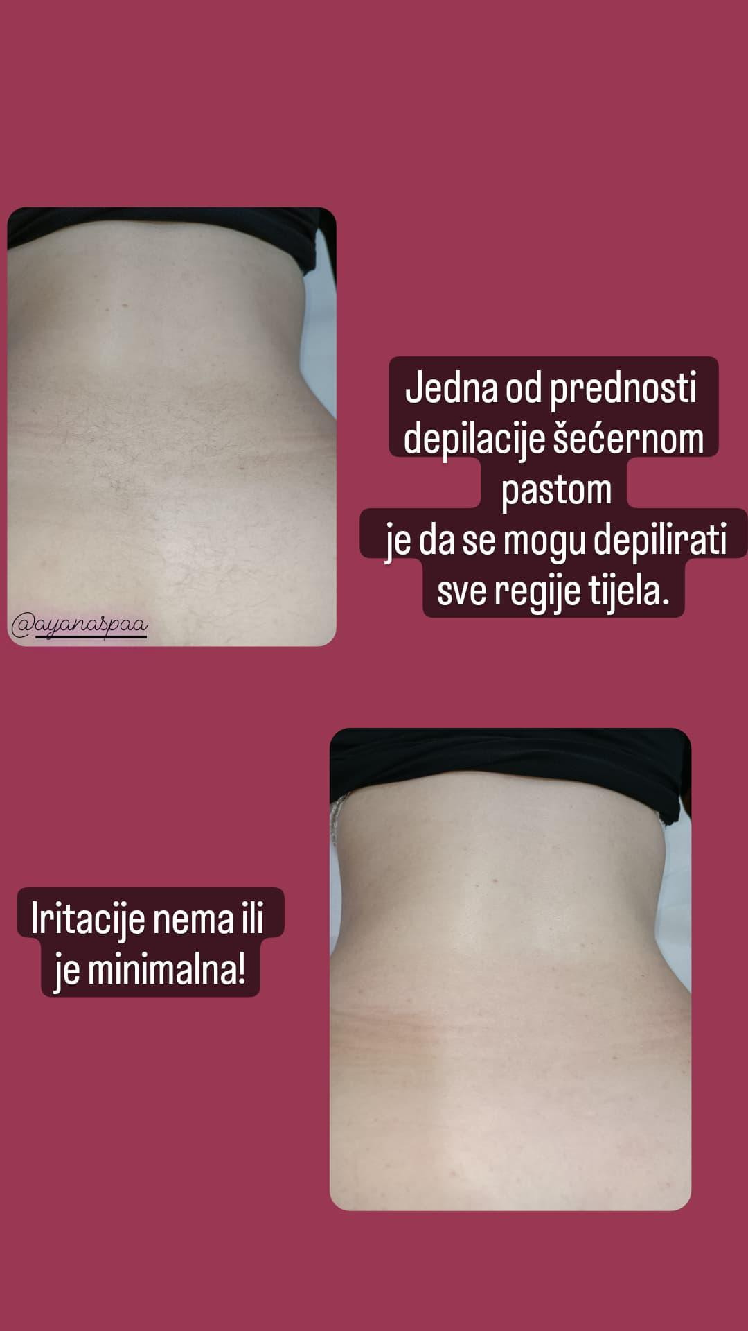 Ayana Spa #sarajevo Depilacija šećernom pastom Depilacija pola leđa šećernom pastom - za dame