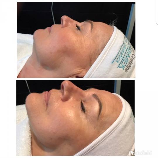 Vedrana #sarajevo Tretman lica Prije više od 60 godina, Christine Schrammek postavila je temelje or