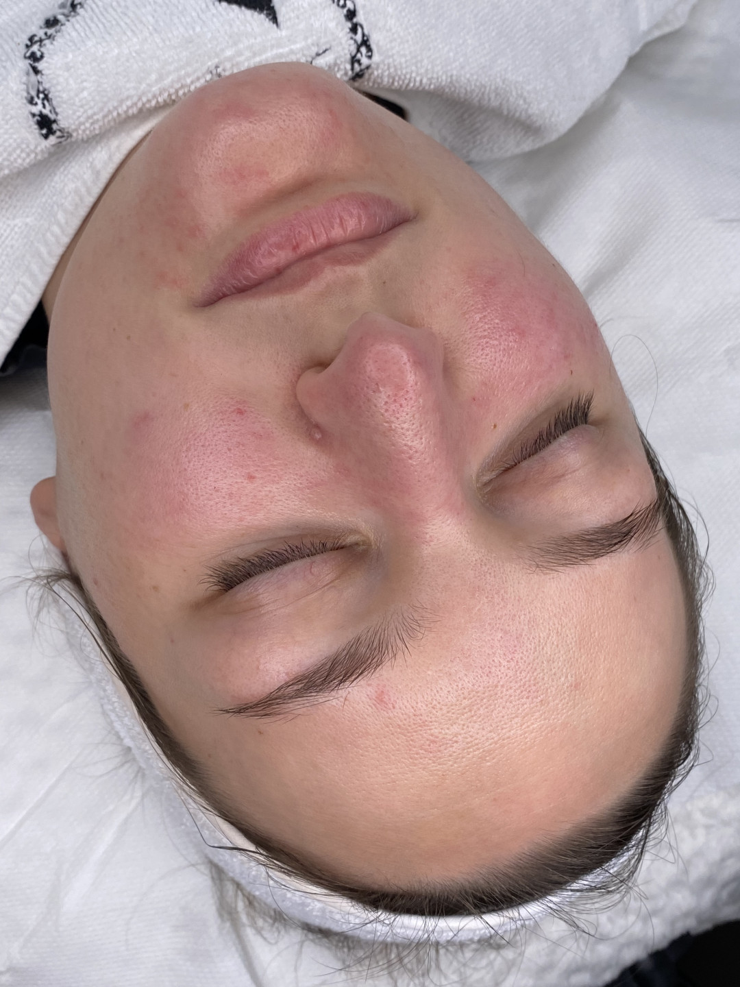 Fabrika ljepote #sarajevo Tretman lica Dubinsko čišćenje lica 4u1 za suhu/normalnu kožu