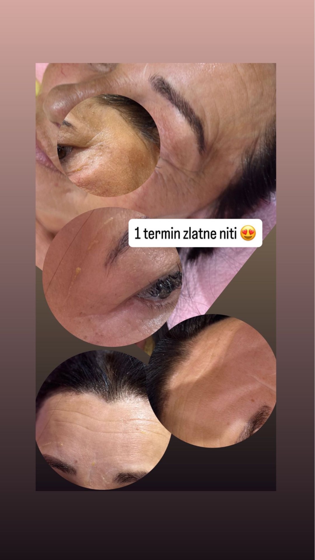 Tretman zlatnim + srebrnim nitima lice - Poezija ljepote, Sarajevo Ojačavanje noktiju Nokti Ojačavanje noktiju, Sarajevo, Novo Sarajevo - Novi Grad