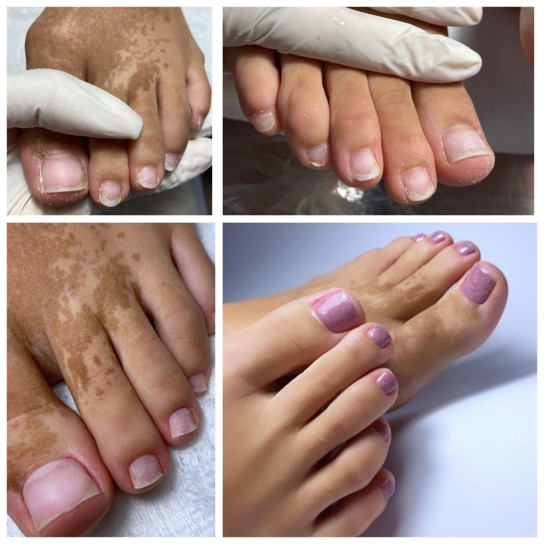 Poezija ljepote #sarajevo Estetski pedikir Klasična pedikura + trajni lak