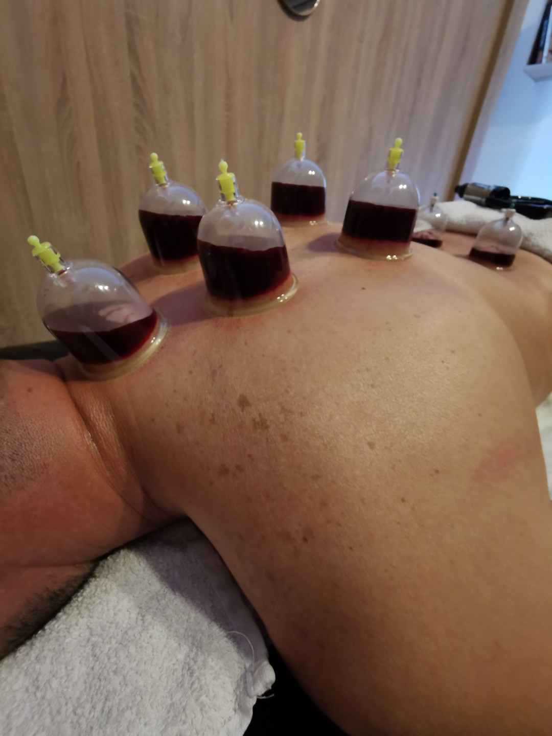 Health Care Koncept #sarajevo Tretmani tijela Hidžama classic