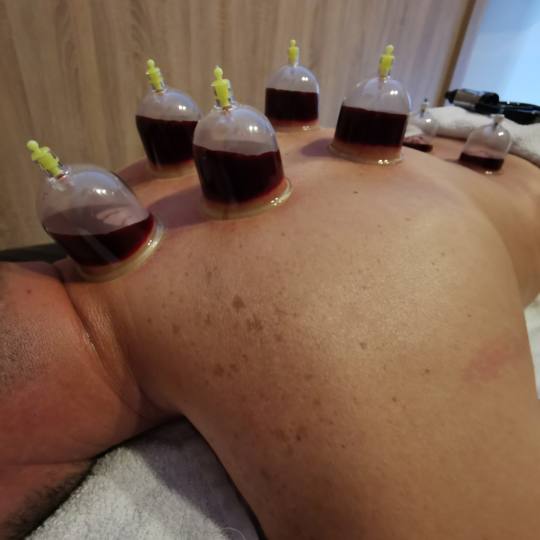 Health Care Koncept #sarajevo Tretmani tijela Hidžama classic Hidžama classic riješenje za napeto