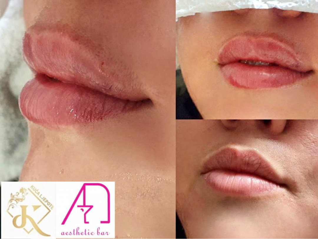 - AEsthetic Bar Academy, Sarajevo Tretman lica Lice Tretman lica, Sarajevo, Novo Sarajevo - Novi Grad