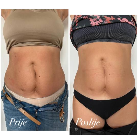 Beauty centar Eden usluga